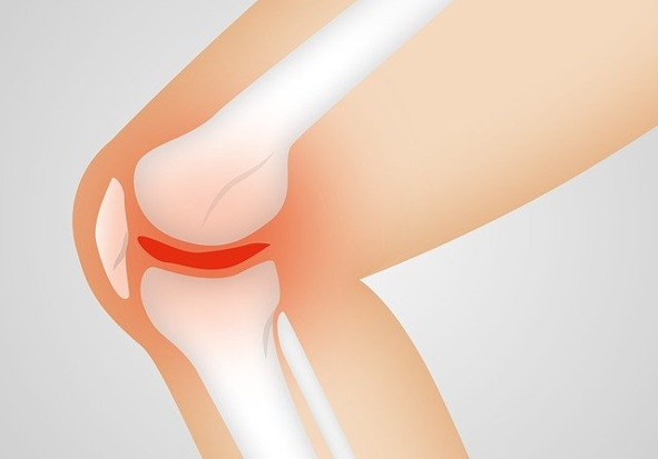膝 裏 の 痛み 腓腹筋